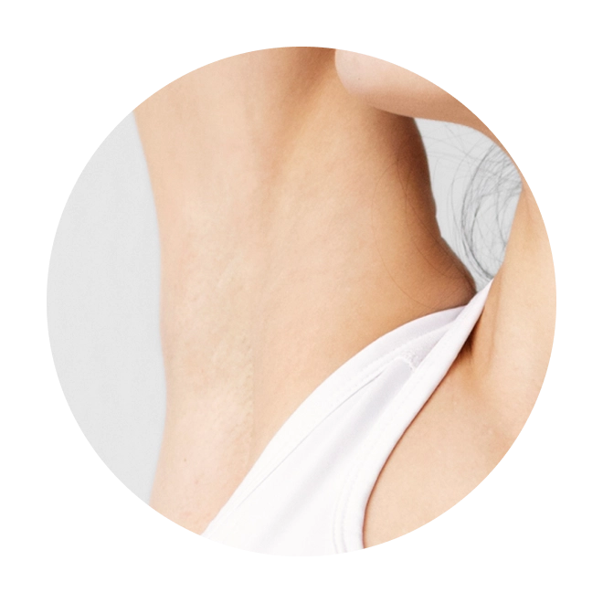 Whiten Underarms